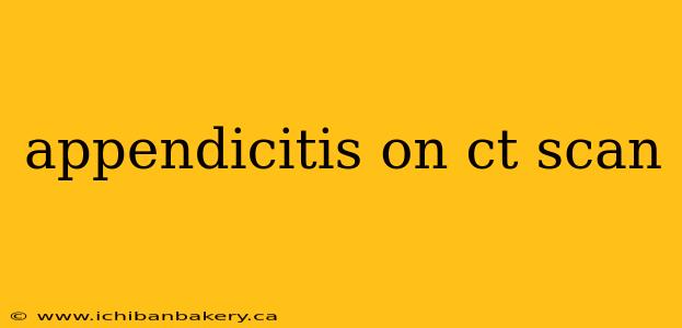 appendicitis on ct scan