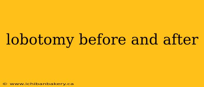 lobotomy before and after