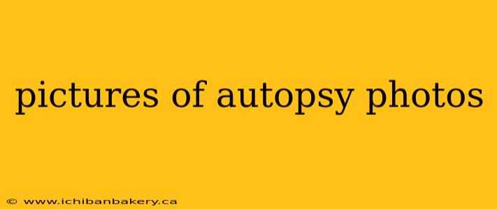 pictures of autopsy photos