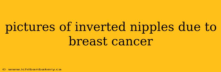 pictures of inverted nipples due to breast cancer